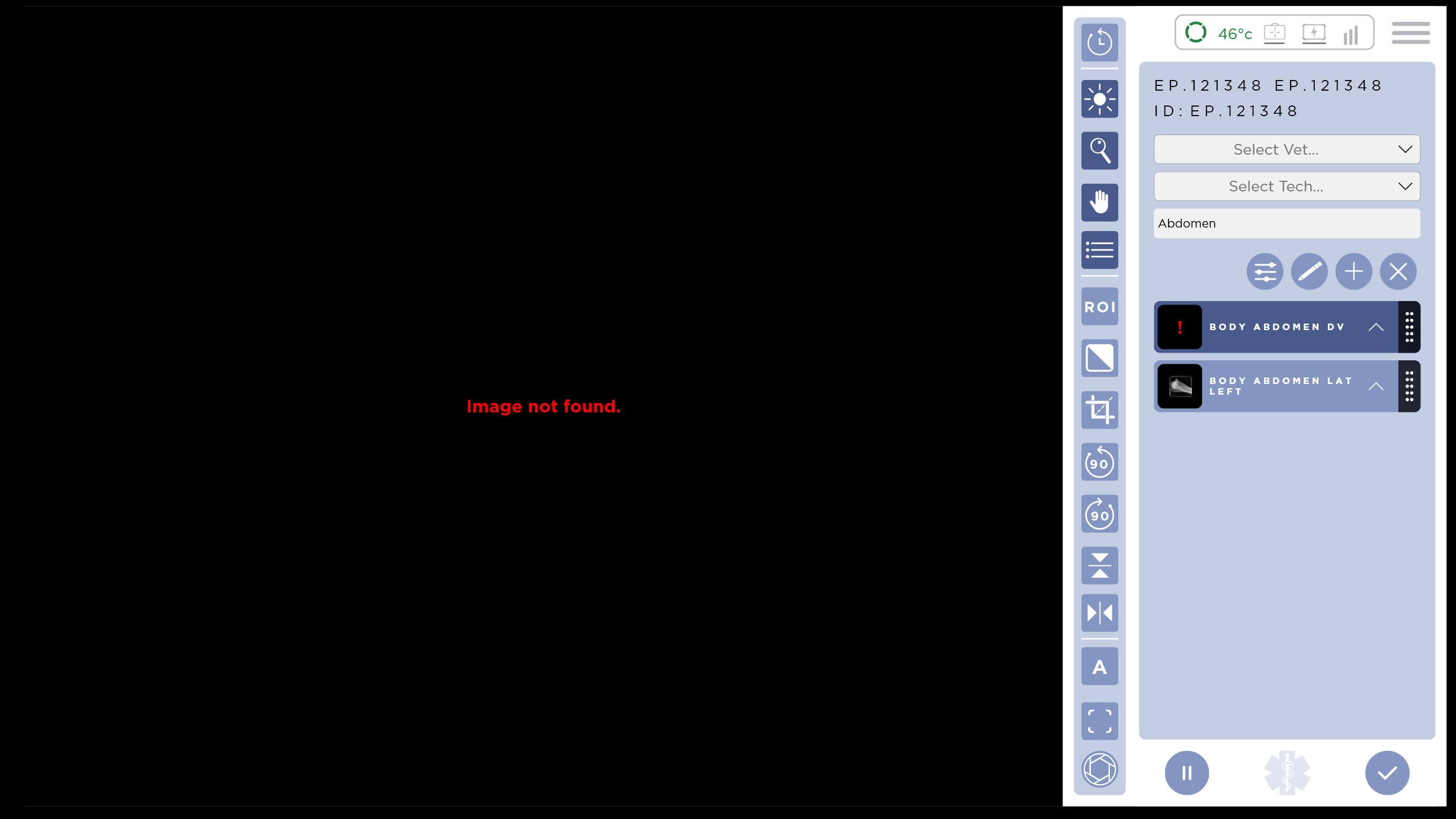 Missing Image