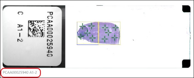 AccessionNumber