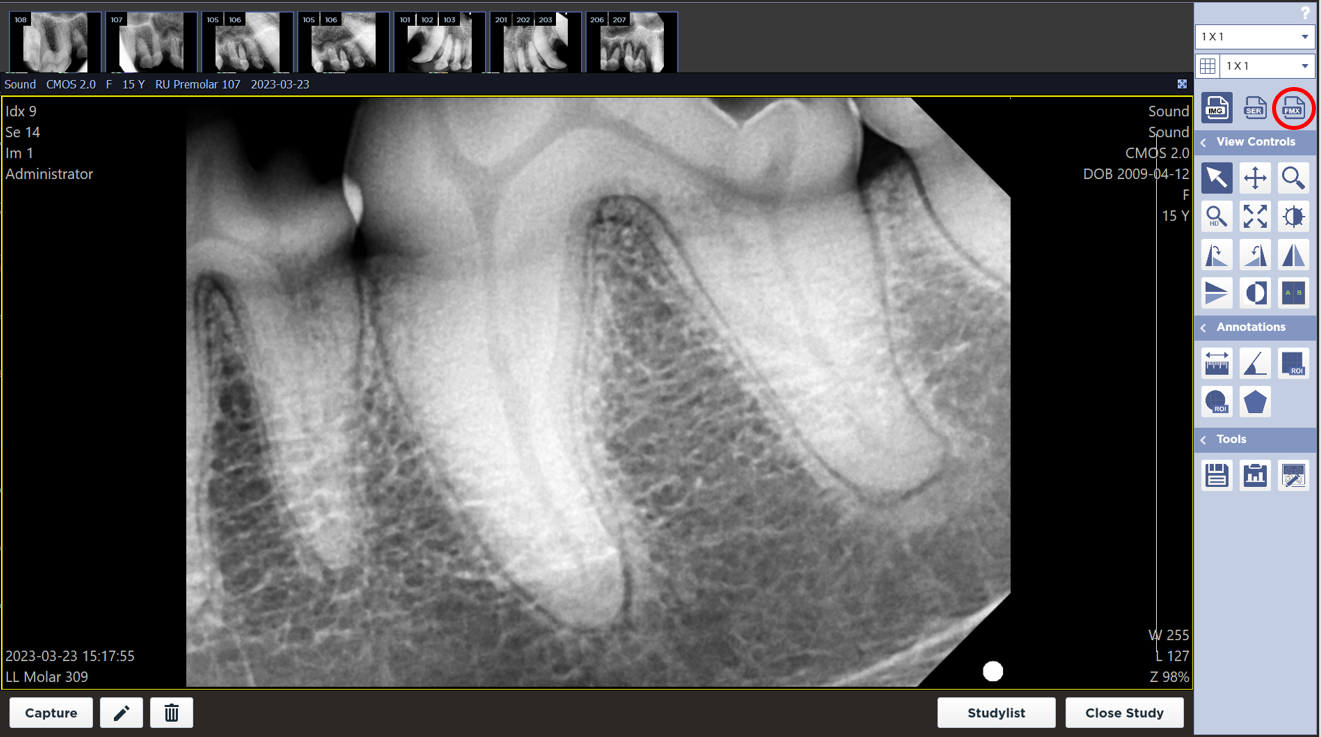 Full Mouth Viewer (FMX) | Sound HD Dental