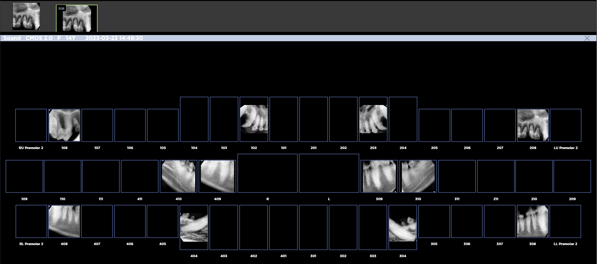 Full Mouth Viewer (FMX) | Sound HD Dental