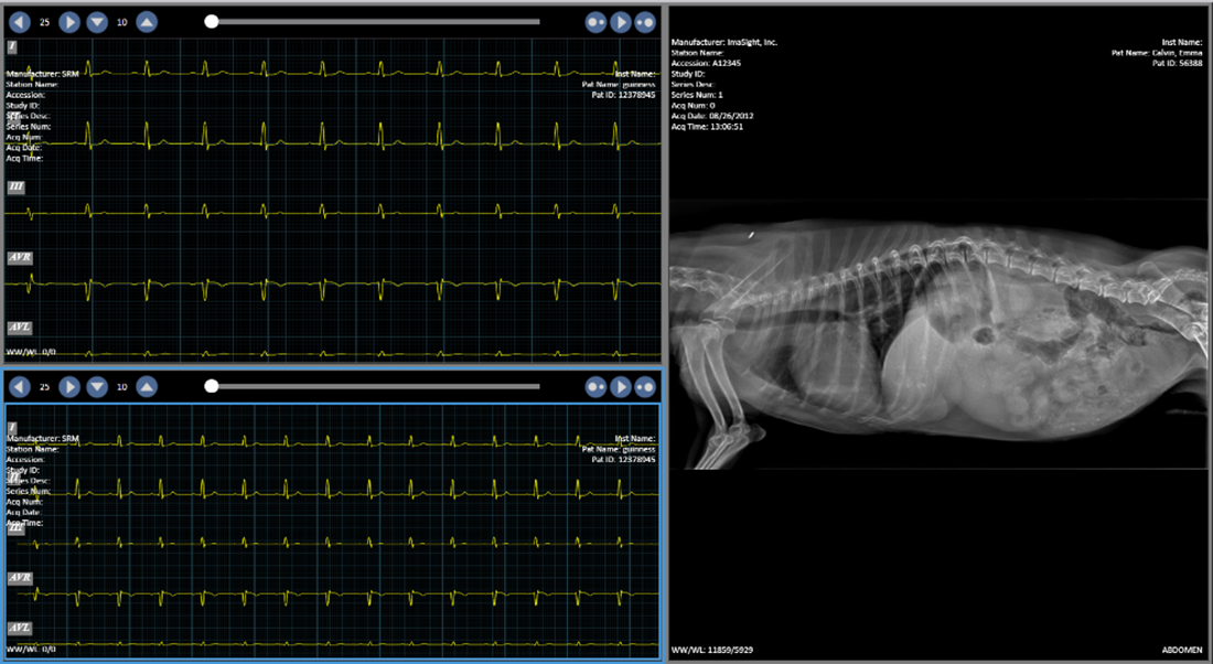 ECG1
