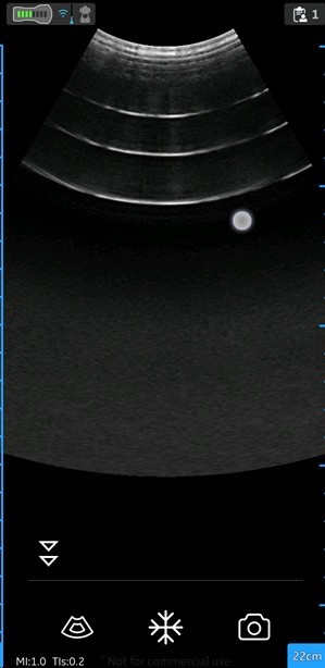Depth adjustment
