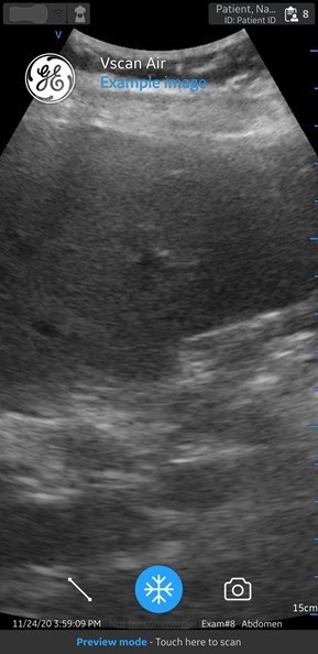 Scan Screen with Patient data