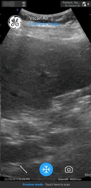 Scan Screen with Patient data