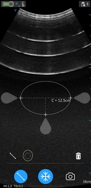 Select Ellipse measurement