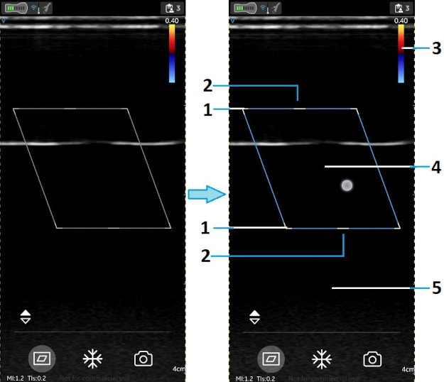 Position and resize ROI