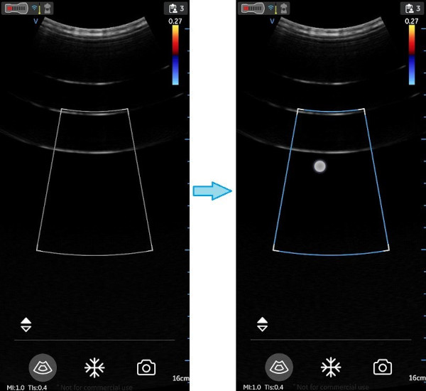 Position and resize ROI