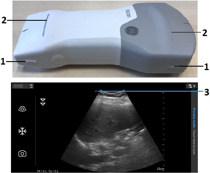 Vscan Air CL Orientation