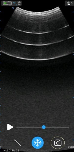 Store still image