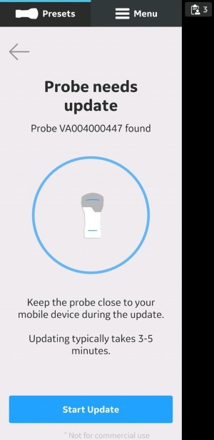 Start Update